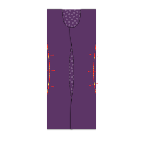 Sew the darts
